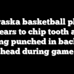 Nebraska basketball player appears to chip tooth after being punched in back of head during game