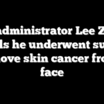EPA administrator Lee Zeldin reveals he underwent surgery to remove skin cancer from his face