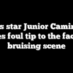 Rays star Junior Caminero takes foul tip to the face in bruising scene