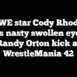 WWE star Cody Rhodes suffers nasty swollen eye after Randy Orton kick at WrestleMania 42